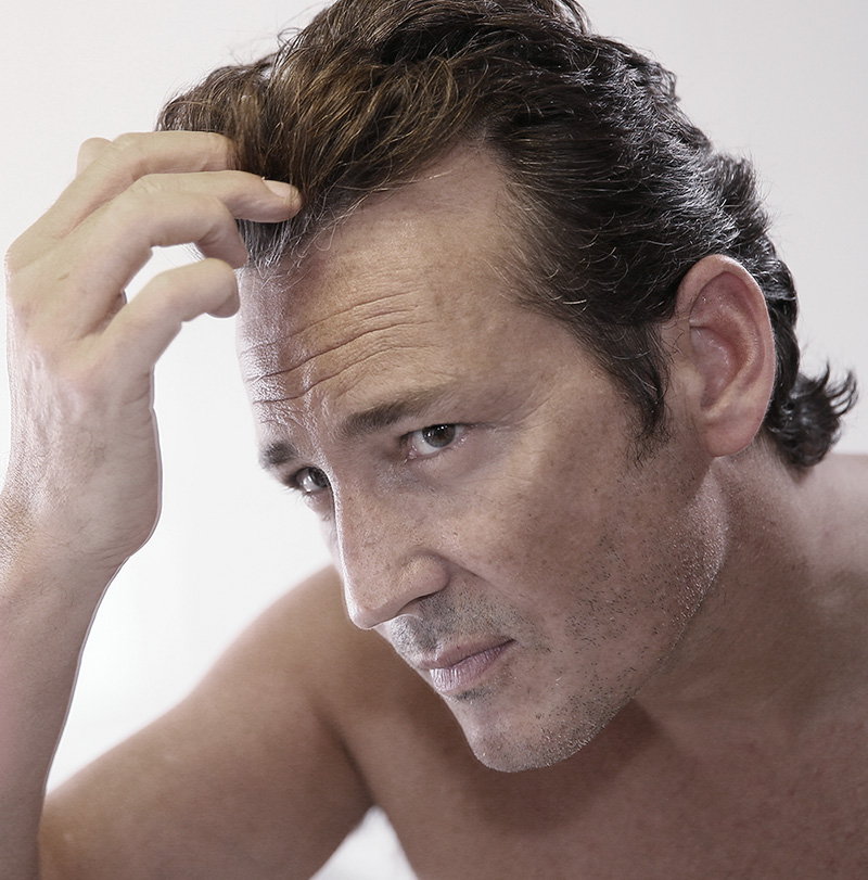 prp-hair-hero-2